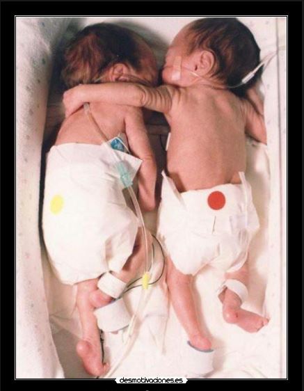 Abrazo Salvador 1995